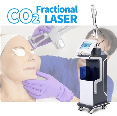HF-Röhre KES Vaginalverjüngungs-Lasermaschine